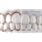 Ирригатор Panasonic EW1611